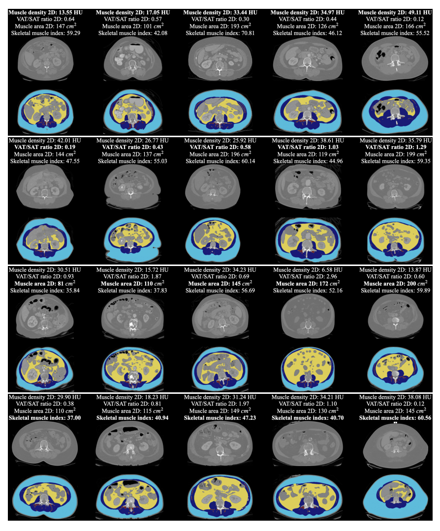 automated_body_composition.png
