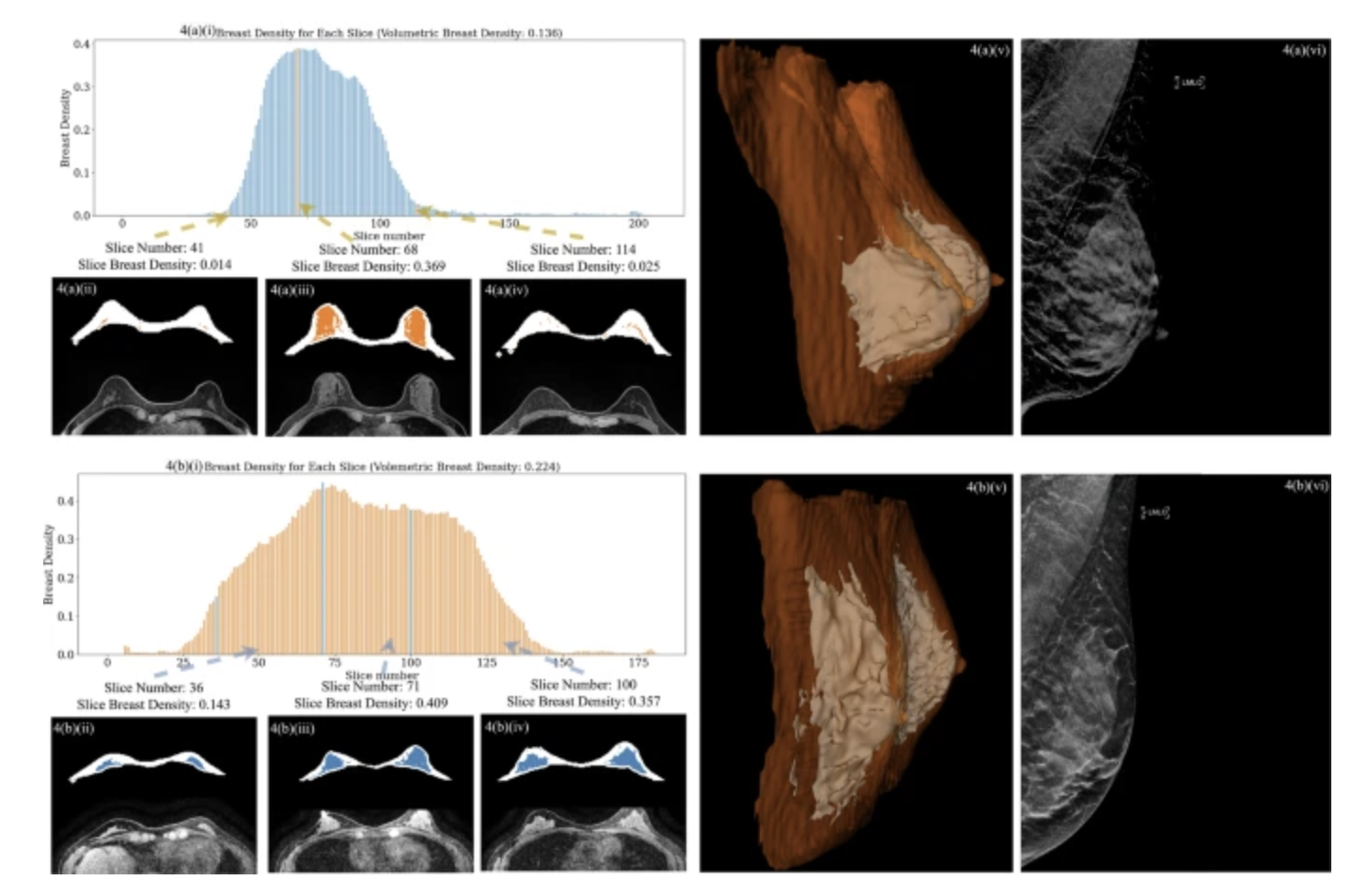 breast_density_paper.png
